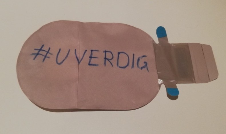 Helfo viderefører uverdige begrensninger på medisinsk utstyr Helfo viderefører uverdige begrensninger på medisinsk utstyr