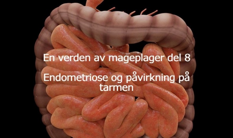 En verden av mageplager del 8 En verden av mageplager del 8